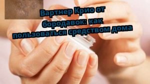 Вартнер Крио от бородавок: как пользоваться средством дома