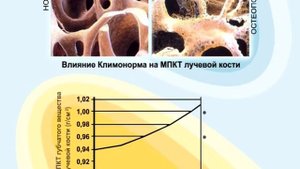 Klimonorm