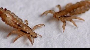 как вши влияли на мировую историю Жертвы вшей