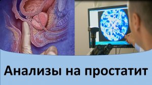 Анализы на простатит