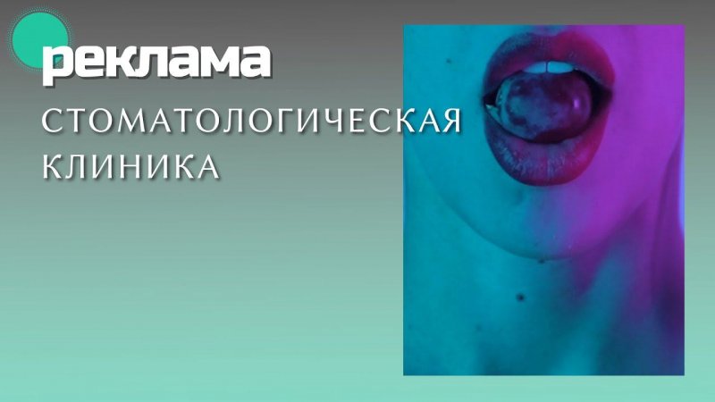 SMOLENSKY DENTAL CLINIC – реклама стоматологической клиники