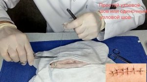 Простой узловой шов или одиночный узловой шов. #рана#доктор_Сунатулло#хирургия#травматологортопед#