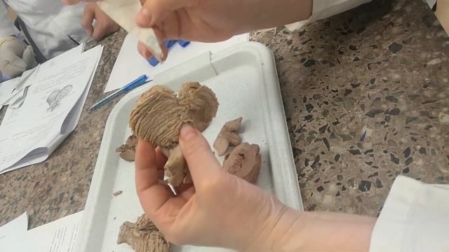 Анатомия | Мост и мозжечок