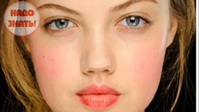 Почему горят (краснеют) щеки?
