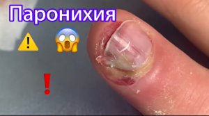 Паронихия??⚠️❗️
