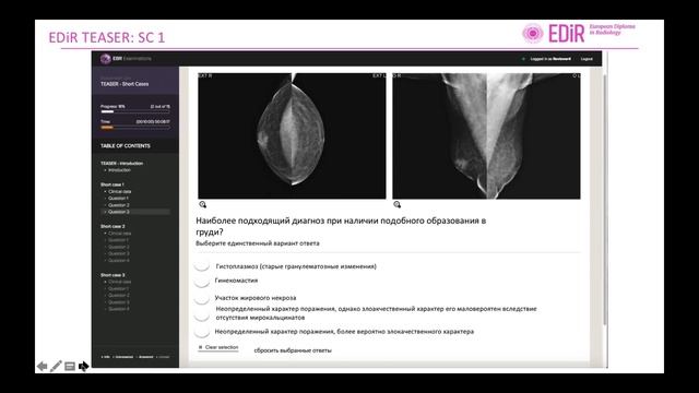 EDiR webinar (Russian) смотреть онлайн