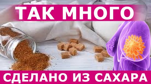 Что из глюкозы делает опухоль и обычная клетка: фолат, метионин, гомоцистеин, аминокислоты.