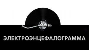 Электроэнцефалограмма ? - звук электроэнцефалограммы и шум ЭЭГ ?️