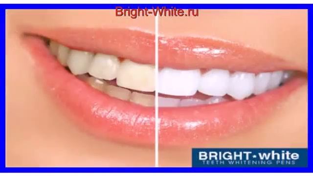Отбеливающий карандаш для зубов.Голливудская улыбка.