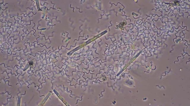 Spirillum volutans смотреть онлайн