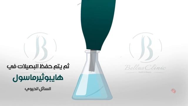 Hair transplant sapphire\/ Процедура пересадки волос методом/تقنيه السفير смотреть онлайн