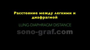 УЗИ - Определение объема плеврального выпота