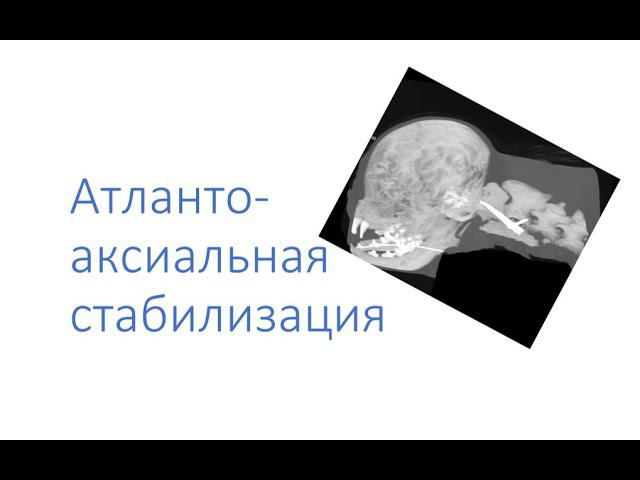 Атланто аксиальная стабилизация