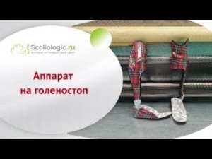 Такие нужные и красивые аппараты на голеностопные суставы