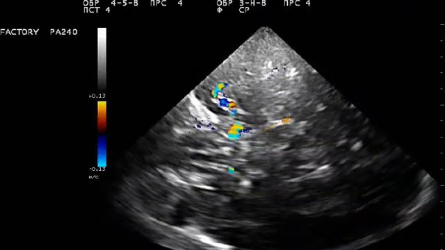 транскран 5 смотреть онлайн