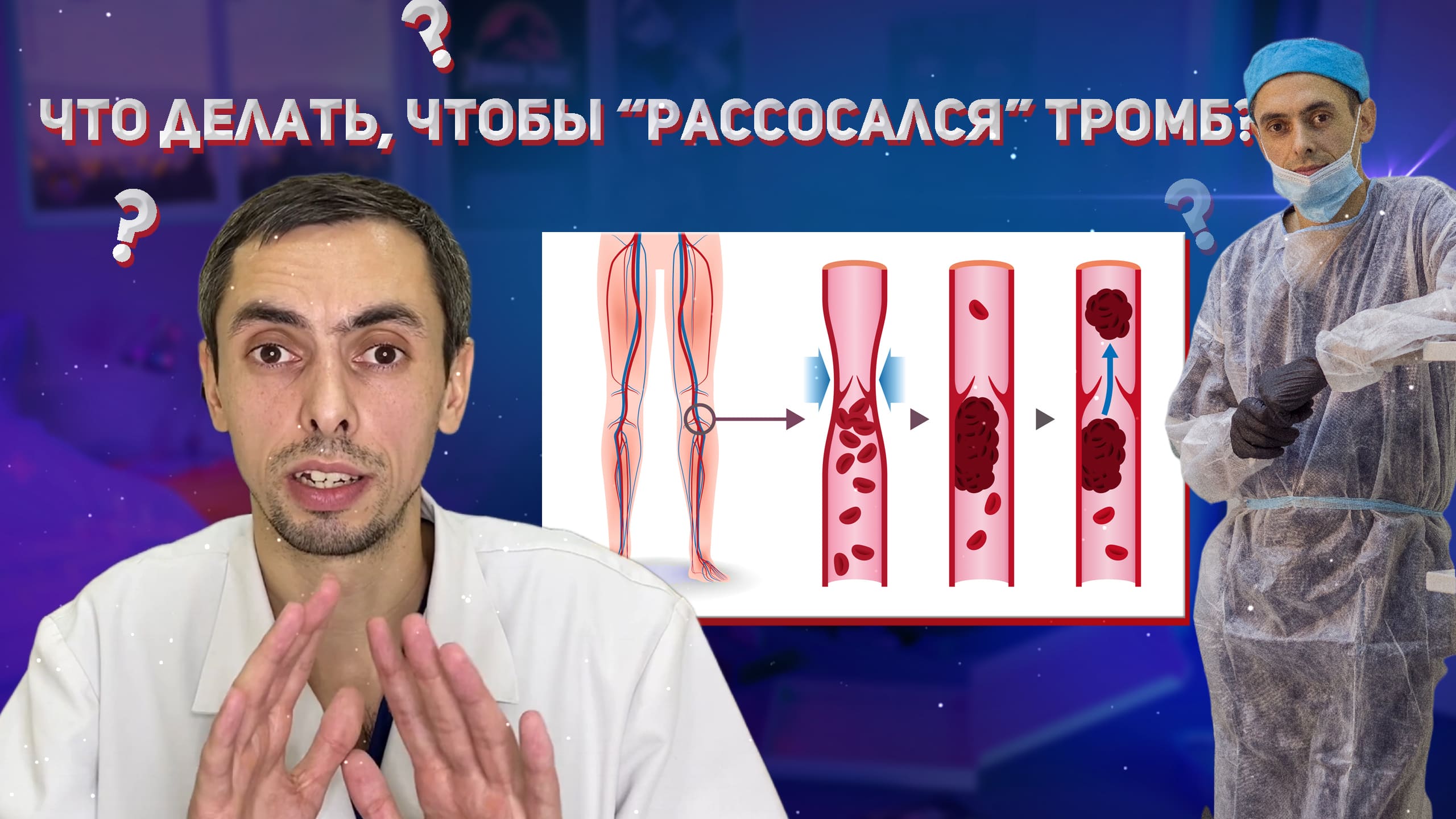 Что делать, чтобы "рассосался" тромб?? #варикоз #флеболог #тромбоз