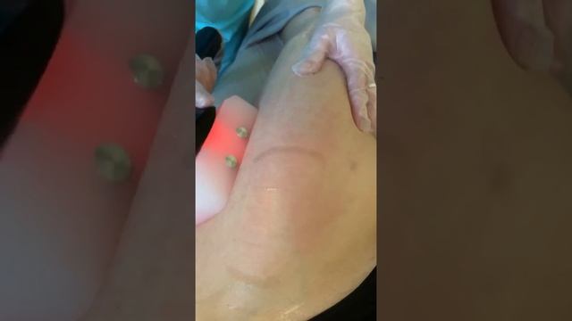 LPG массаж всего тела?❤️ Нижний Новгород ул Академика Сахарова д 1111 смотреть онлайн