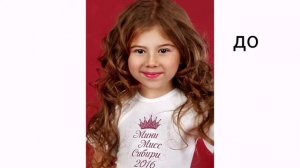 Милана хаметова ДО И ПОСЛЕ| КАКАЯ РАНЬШЕ БЫЛА МИЛАНА ?!