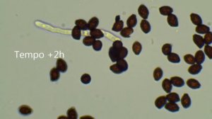 Germinazione spora del fungo Lacrymaria lacrymabunda