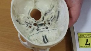 Отверстия черепных нервов на основании черепе