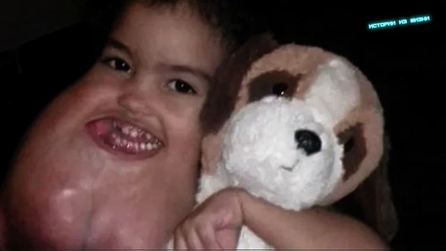 Проснувшись, девочка почувствовала сильную боль в подбородке! Теперь она… смотреть онлайн