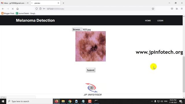 Melanoma Detection Using Convolutional Neural Network | Python Final Year IEEE Project