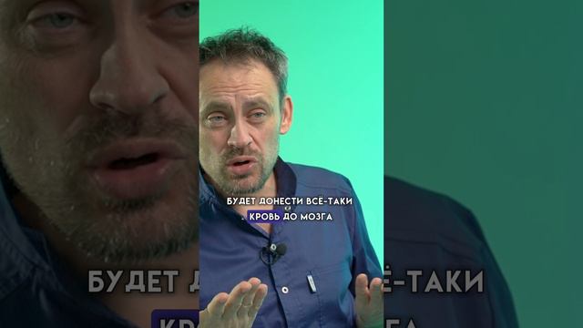 Нарушение мозгового кровообращения.
