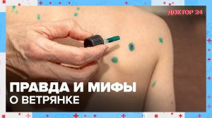 Правда и мифы о ВЕТРЯНКЕ | Доктор 24