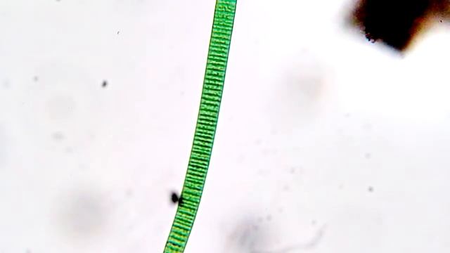 Oscillatoria, Microscopy, Biology, Microbiology смотреть онлайн