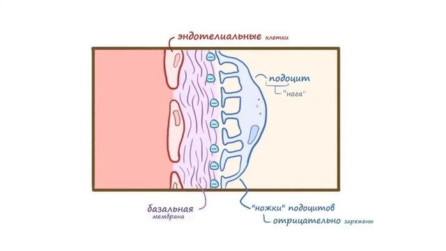 Болезнь Минимальных Изменений (нефротический синдром) лекция