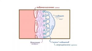 Болезнь Минимальных Изменений (нефротический синдром) лекция