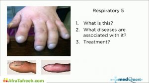 MedQuest’s Get Physical 2023 — Дыхательная система 1/2 РАЗДЕЛ — (для USMLE Step 1, COMLEX)