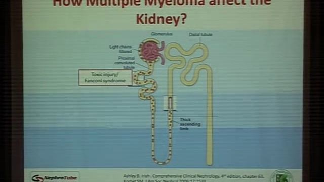 Plasma Cell Dyscrasias and The Kidney diagnosis Dr Mohammed Abdel Gawad смотреть онлайн