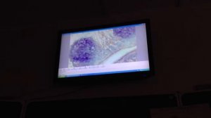 Гистология. Небная миндалина