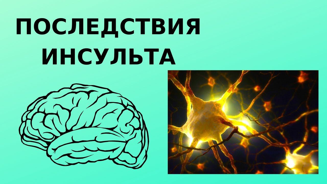 Последствия инсульта. Доктор Лисенкова