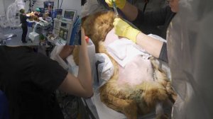 Удаление опухоли позвоночника