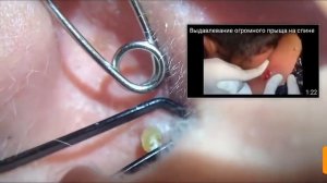 Большая черная точка в ухе