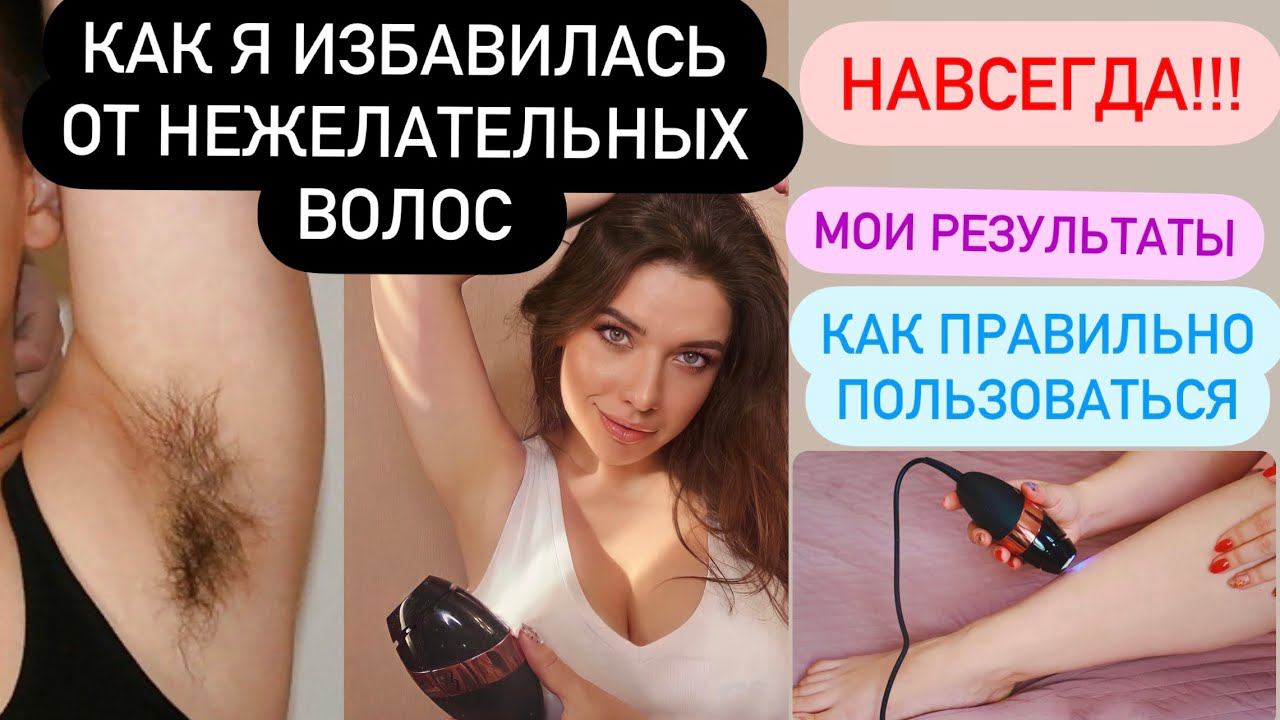 УДАЛЕНИЕ ВОЛОС НАВСЕГДА! ЭПИЛЯЦИЯ. ДОМАШНИЙ ФОТОЭПИЛЯТОР. ГЛАДКАЯ КОЖА. SmoothSkin Bare Plus