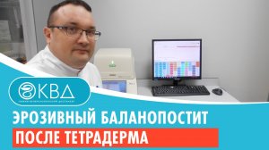 ? Эрозивный баланопостит после тетрадерма. Клинический случай №270