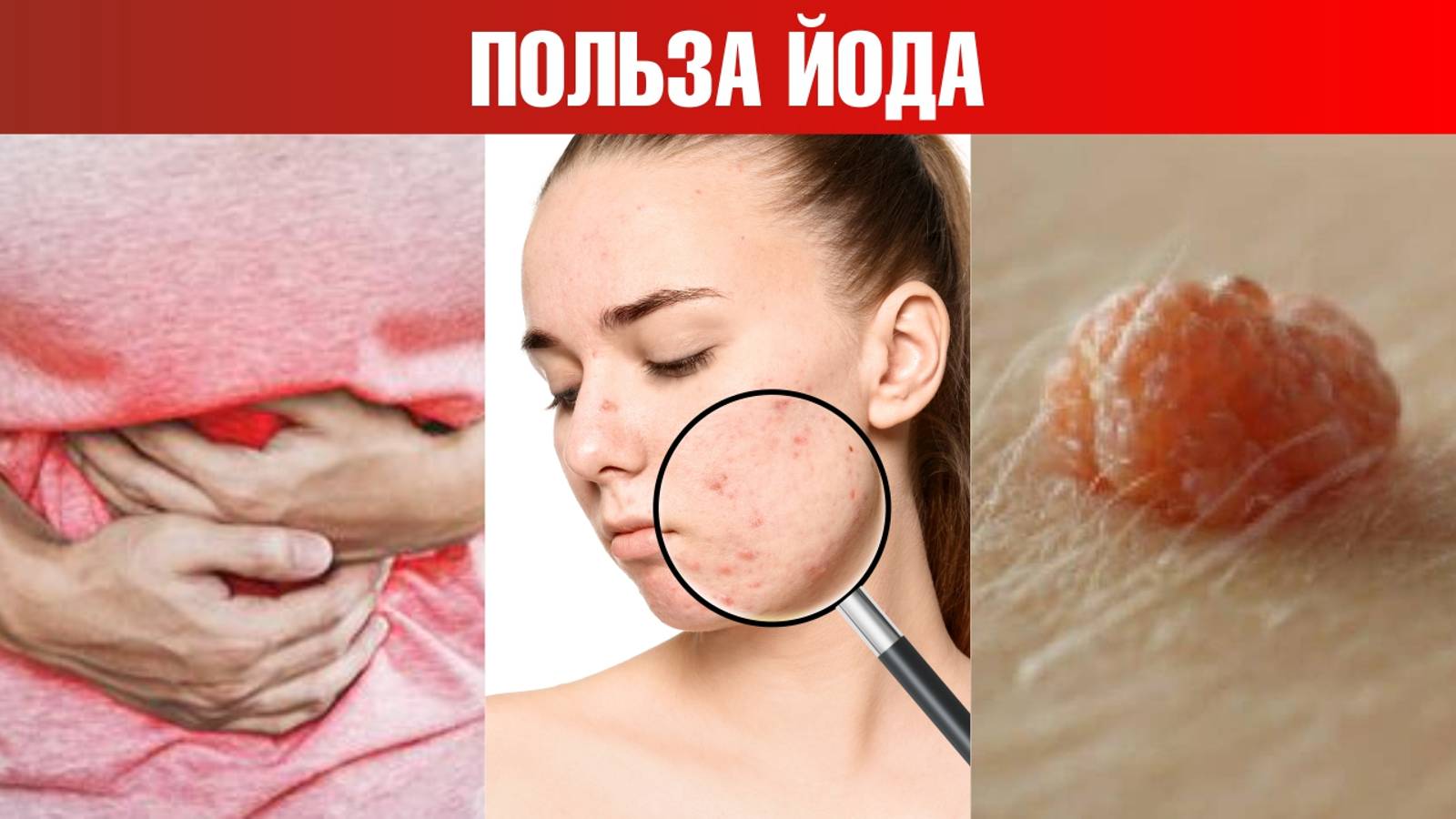 Как определить дефицит йода дома? 🧐 Польза йода