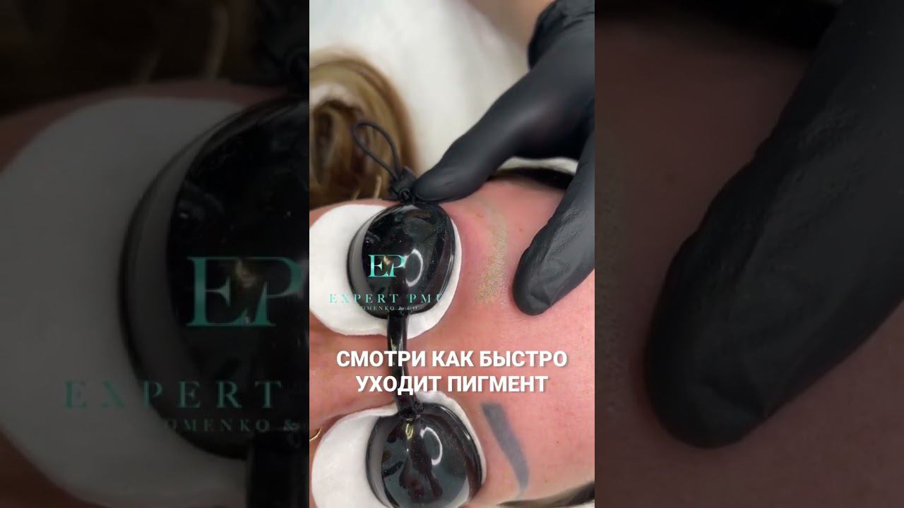 Лазерное удаление бровей до и после!  #удалениетатуажа #лазерноеудаление #лазерноеудаление