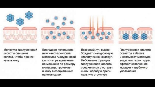Лазерная биоревитализация