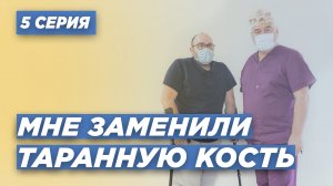 ИСТОРИЯ ПАЦИЕНТА: МНЕ ЗАМЕНИЛИ ТАРАННУЮ КОСТЬ - 5 СЕРИЯ. КАК ЗА ГОД ПОСТАВИТЬ ПАЦИЕНТА НА НОГИ.