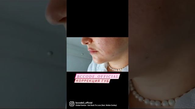 Форма губки, коррекция губ/Москва