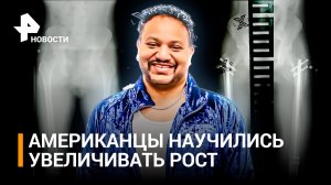 Увеличение роста с помощью аппарата из СССР вызвало бьюти-бум в США / РЕН Новости