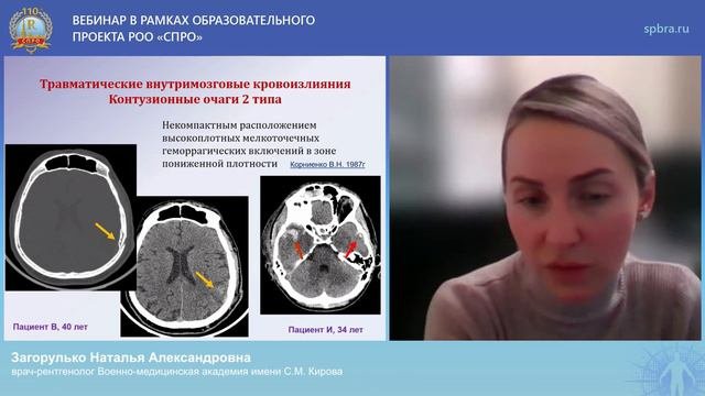 Вебинар 