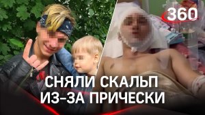 Сняли скальп из-за цвета волос. Кровавые разборки в Электростали. Парня чуть не убили за прическу