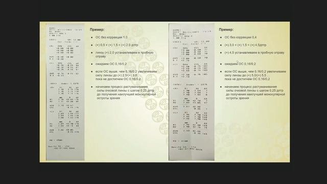 Стеклянная циклоплегия