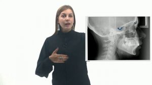 Венозные синусы/Разбор рентгенограммы черепа// MedTalks