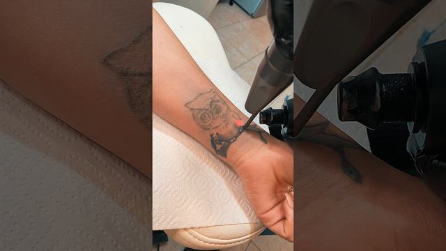 СОВЕНКА Свели   ✅ САНКТ-ПЕТЕРБУРГ #рекомендации  #удалениетату #топ #Питер  #tattoo